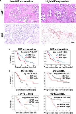 MIF promotes cell invasion by the LRP1-uPAR interaction in pancreatic cancer cells